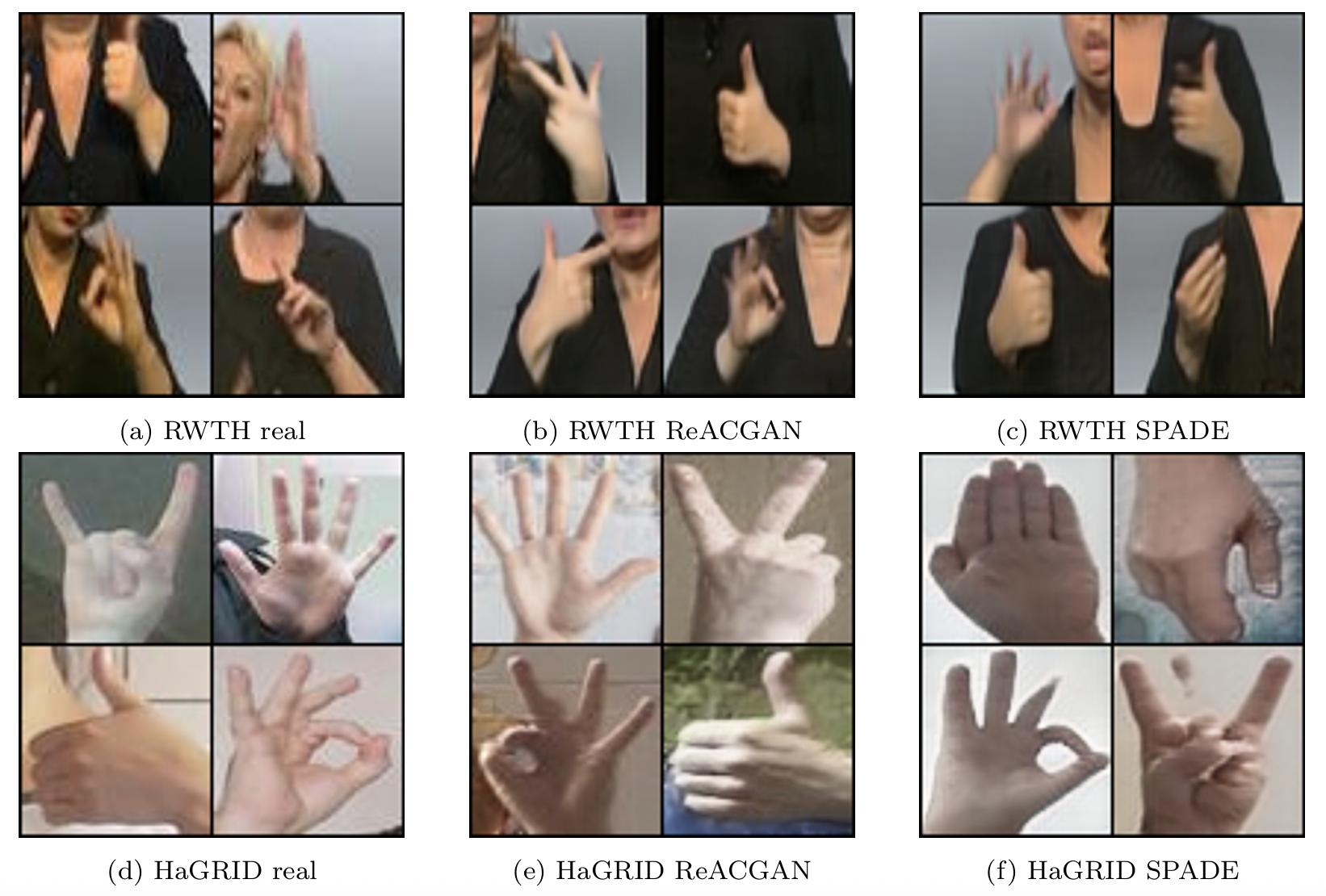 Bringing balance to hand shape classification: Mitigating data imbalance through generative models